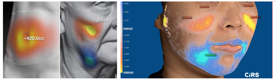 化妆品,功效评价,VECTRAH2 3D,医美