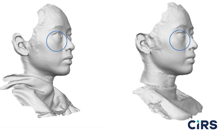 化妆品,功效评价,VECTRAH2 3D,医美
