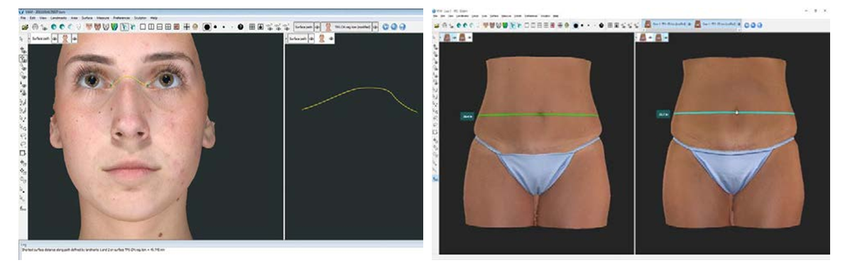 化妆品,功效评价,VECTRAH2 3D,医美
