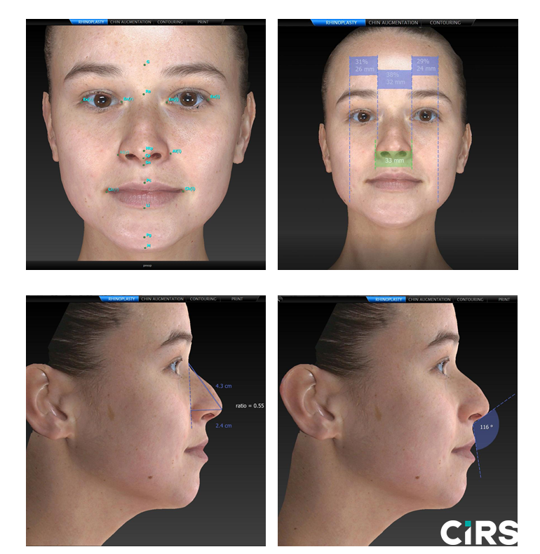 化妆品,功效评价,VECTRAH2 3D,医美