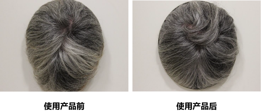 头皮健康,红斑,,丘疹,脓疱,评价方法