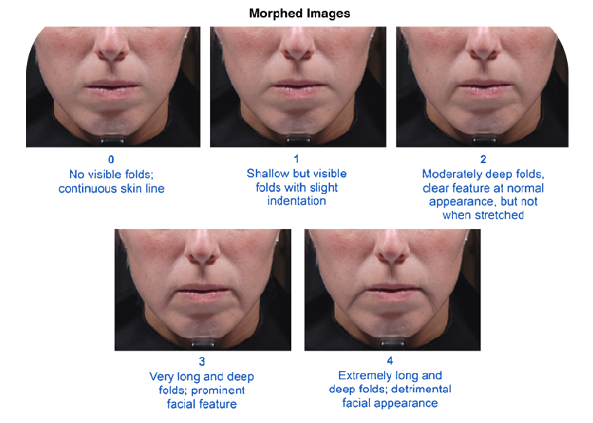 CIRS,功效评价,技术实践,木偶纹