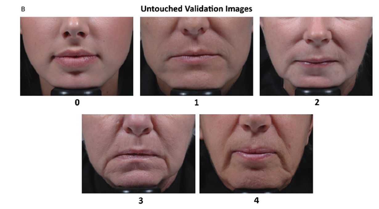CIRS,功效评价,技术实践,木偶纹